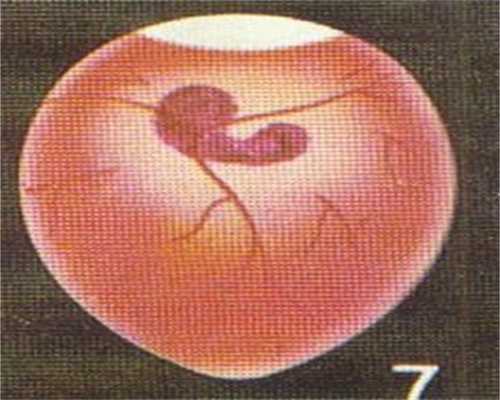 亲亲宝贝代孕公司武汉：武汉喜孕代孕网：探秘排卵期 女人的排卵过程大解密