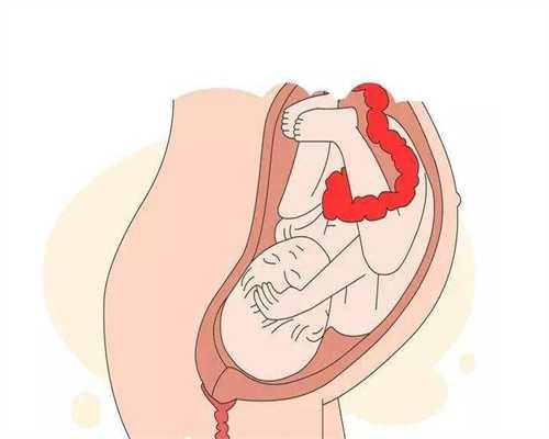 武汉东方百年代孕：武汉同济医院代孕：宫腔积血能吃红枣吗 你不知道的神奇