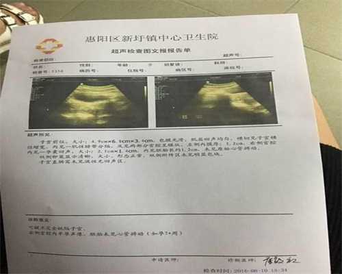 武汉代孕一次有多少钱：武汉盲捐卵子：1617689863937