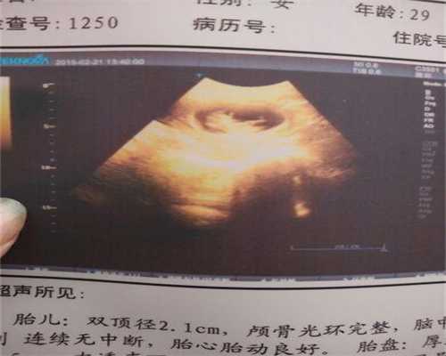 武汉供卵试管婴儿医院：武汉代生儿子包性别：1617677138889