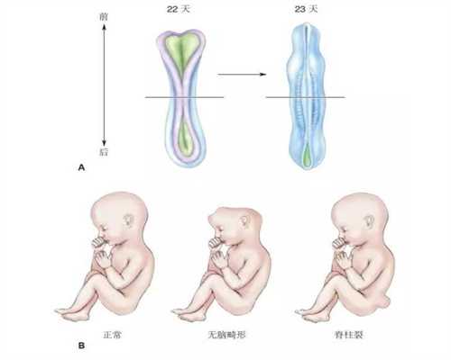 武汉试管婴儿济南中介：b超能检查出什么妇科问题