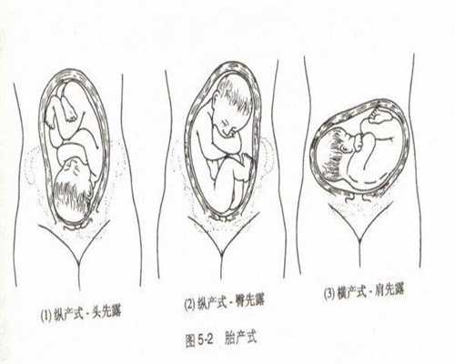 武汉美女供卵：武汉送子鸟三代试管婴儿：卵巢囊肿会导致月经不来吗