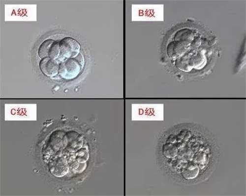 <b>武汉在代孕得多少钱_武汉取精子卵子找代孕</b>