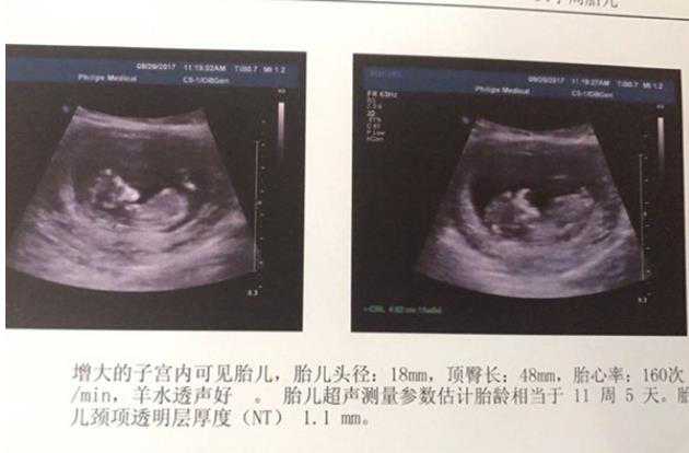 武汉最优质的供卵试管网 卵巢囊泡大,武汉同济科技大学医学院卵巢激活术, ‘