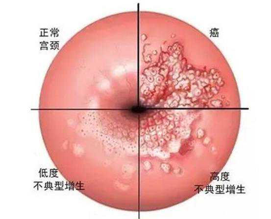 河南省武汉市人民医院做试管婴儿可以选性别吗